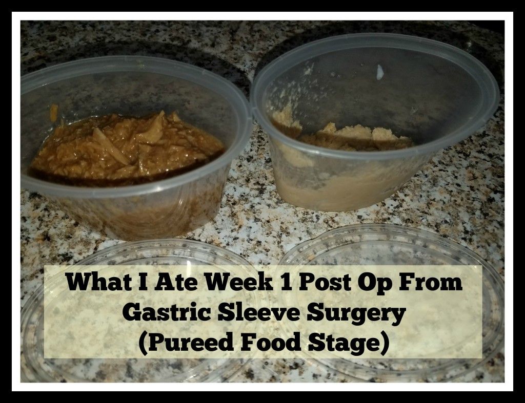 Gastric Sleeve Recipes Stage 2